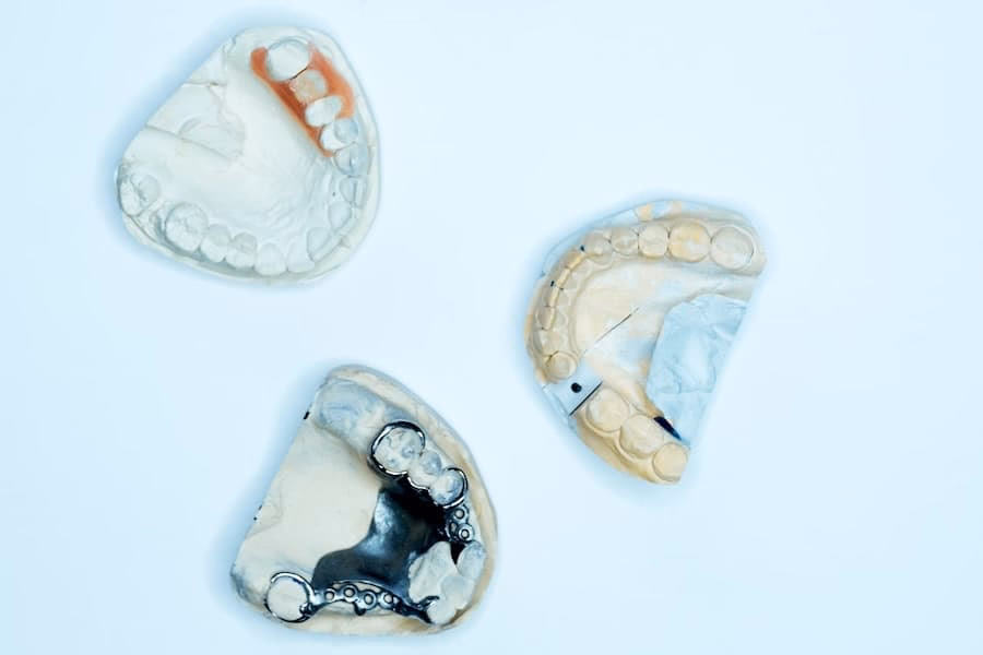 ¿Cómo ocultar el espacio en el alambre de ortodoncia?