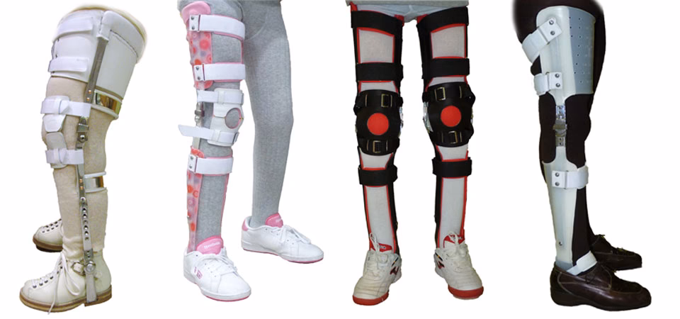 ¿Qué pasa si tengo esclerosis múltiple?