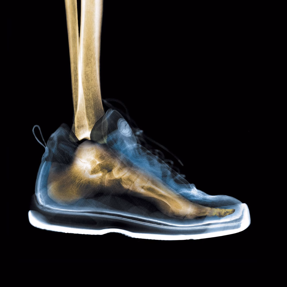 ¿Cuándo es el día de la cirugía plastica en León?