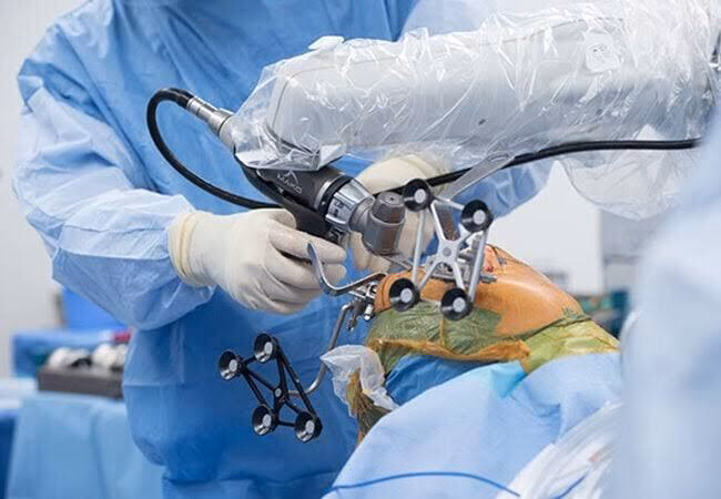 ¿Qué es la cirugía ortopédica asistida por brazo robótico Mako?