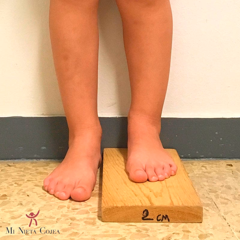 ¿Qué es la cirugía ortopédica y Traumatología?