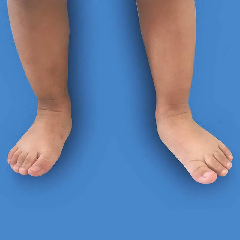 ¿Cómo se diagnostica la traumatología del pie?