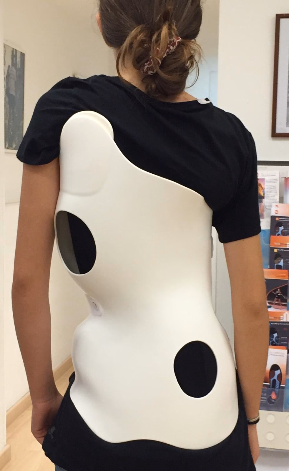 ¿Qué es un corsé de cheneau?