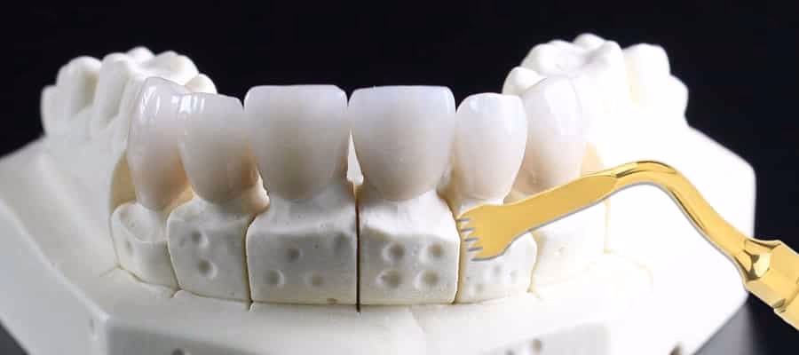 ¿Cuál es la diferencia entre corticotomías y Cirugía osteogénica?