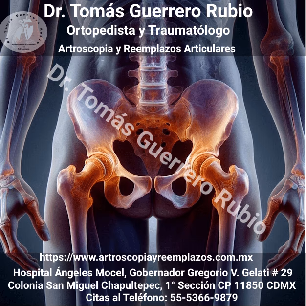 ¿Cuáles son los signos de DDC unilateral de diagnóstico tardío?