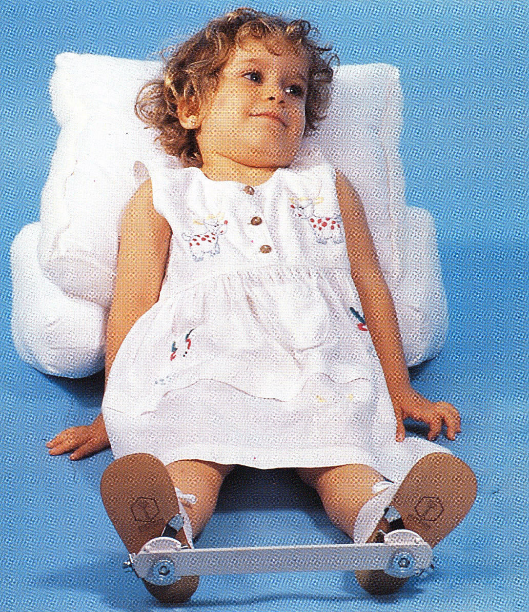 ¿Cuáles son las contraindicaciones de la férula de Dennis Brown?