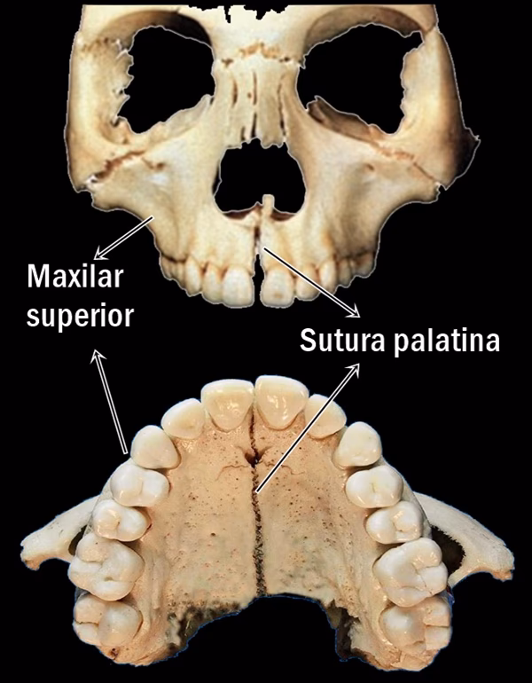 ¿Qué pasa si tengo in coordinación en los maxilares?