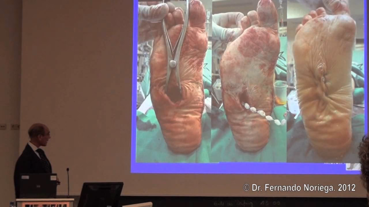 ¿Qué suerte encontró el Dr. Fernando Noriega Díaz?