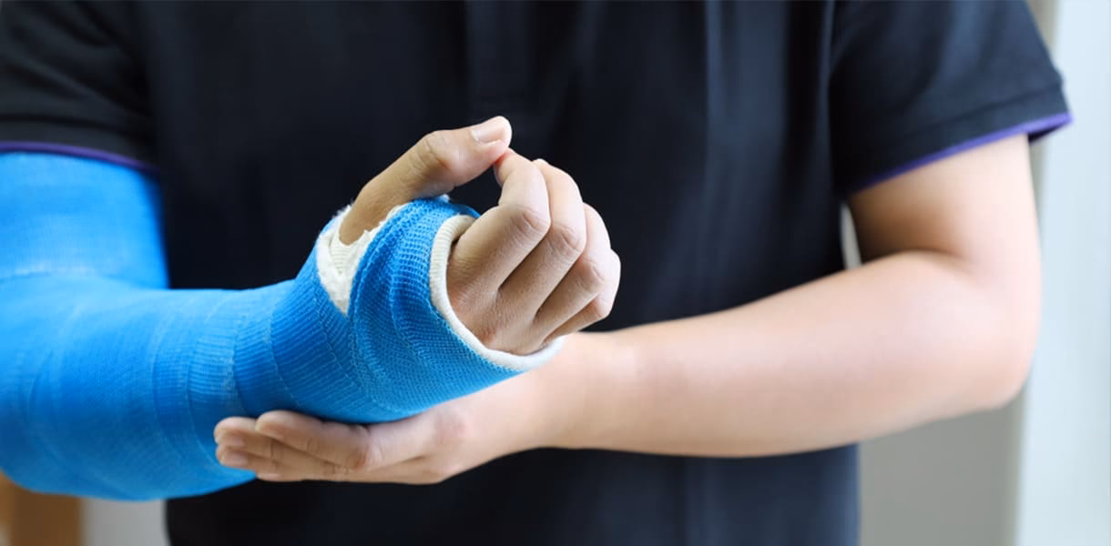 ¿Qué es el soporte de fibra de vidrio?