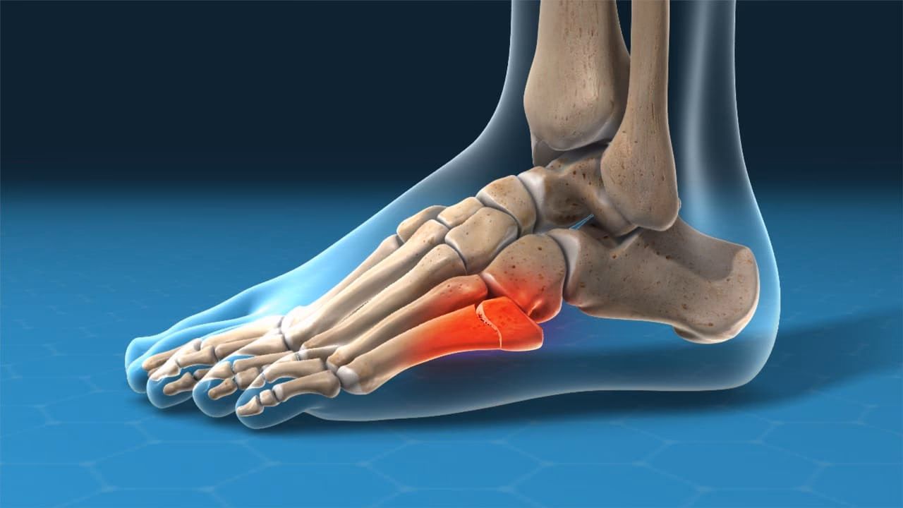 ¿Cuáles son las alteraciones ortopédicas de los pies?