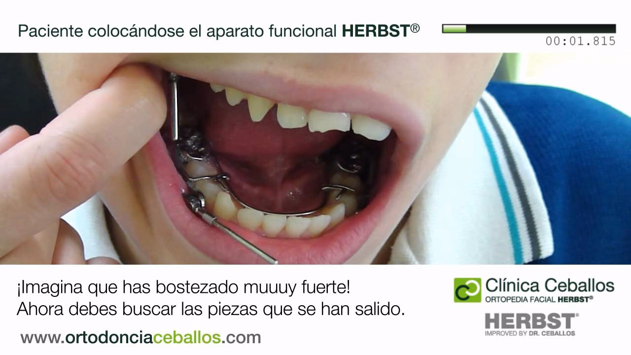 ¿Qué es Herbst y para qué sirve?