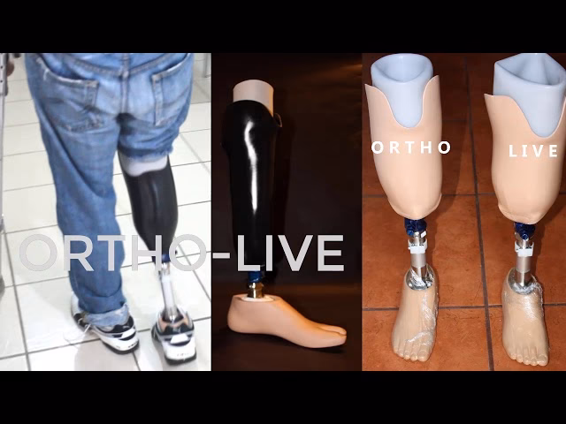 ¿Cómo elegir un pie protésico?