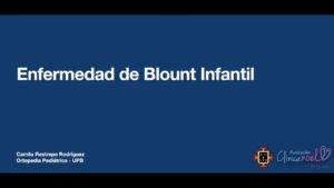 Enfermedad de Blount: Guía Completa de Tratamiento | Ortopedia Genilii