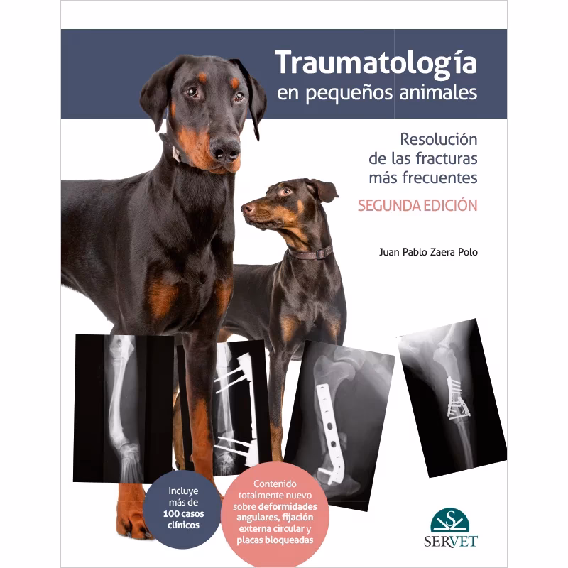 ¿Cómo se realiza el tratamiento ortopédico de fractura maxilar?