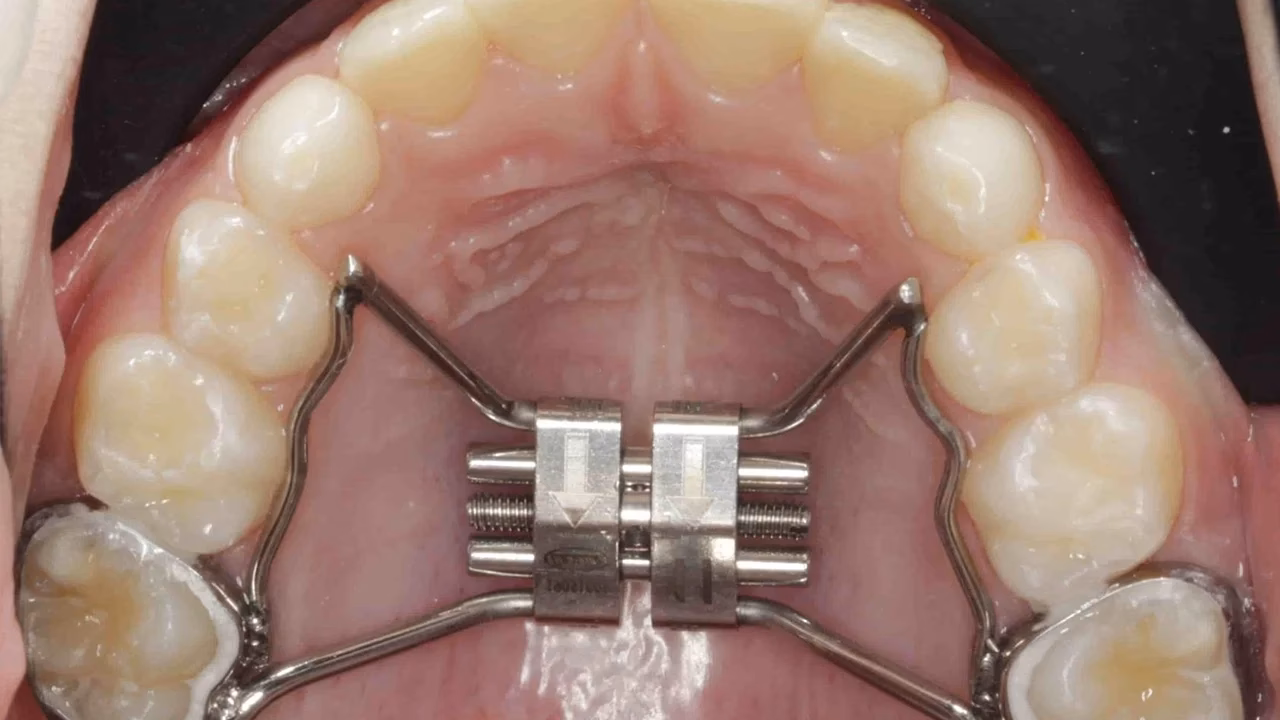 ¿Por qué estudiar un master en modalidad semipresencial?