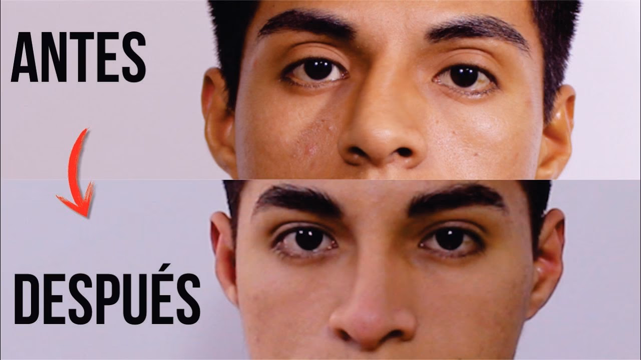 ¿Cuánto cuesta una operación de nariz torcida?