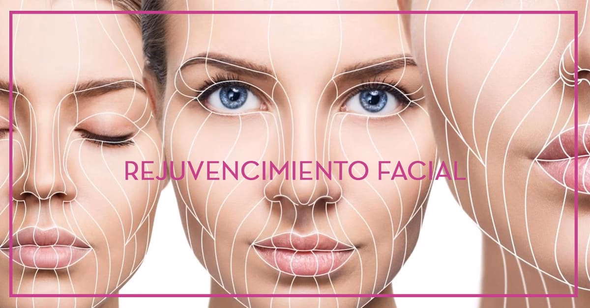 ¿Cuáles son los derechos de neovital Health SL?