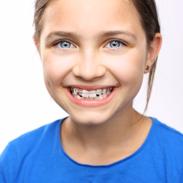 ¿Qué diferencia hay entre ortodoncia y Ortopedia Funcional?