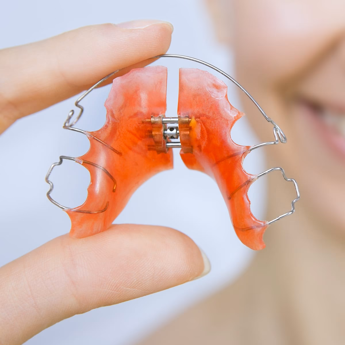 ¿Qué es la ortodoncia?