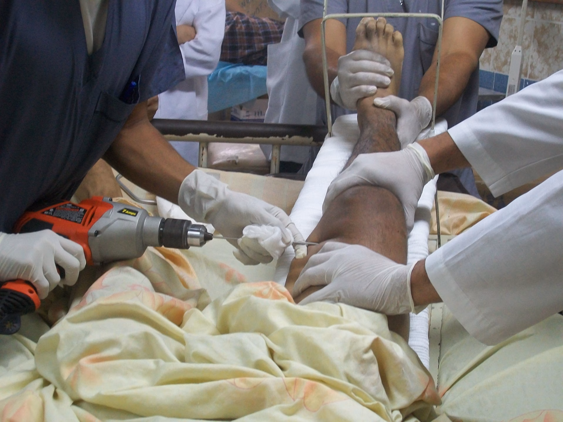 ¿Cuál es la relación entre la cirugía ortopédica y la traumatología?