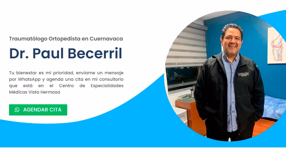 ¿Cuál es el significado de Becerril?