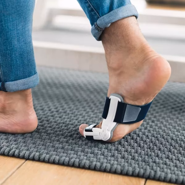 ¿Cuánto tiempo se puede recuperar de una operación de juanetes?