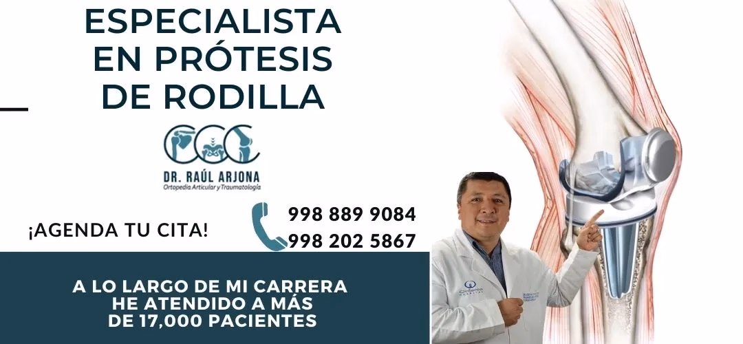 ¿Cuánto cuesta la ortopedia en Cancún?