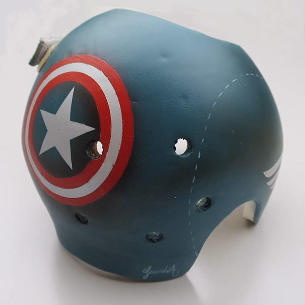 ¿Qué es la plagiocefalia posicional?