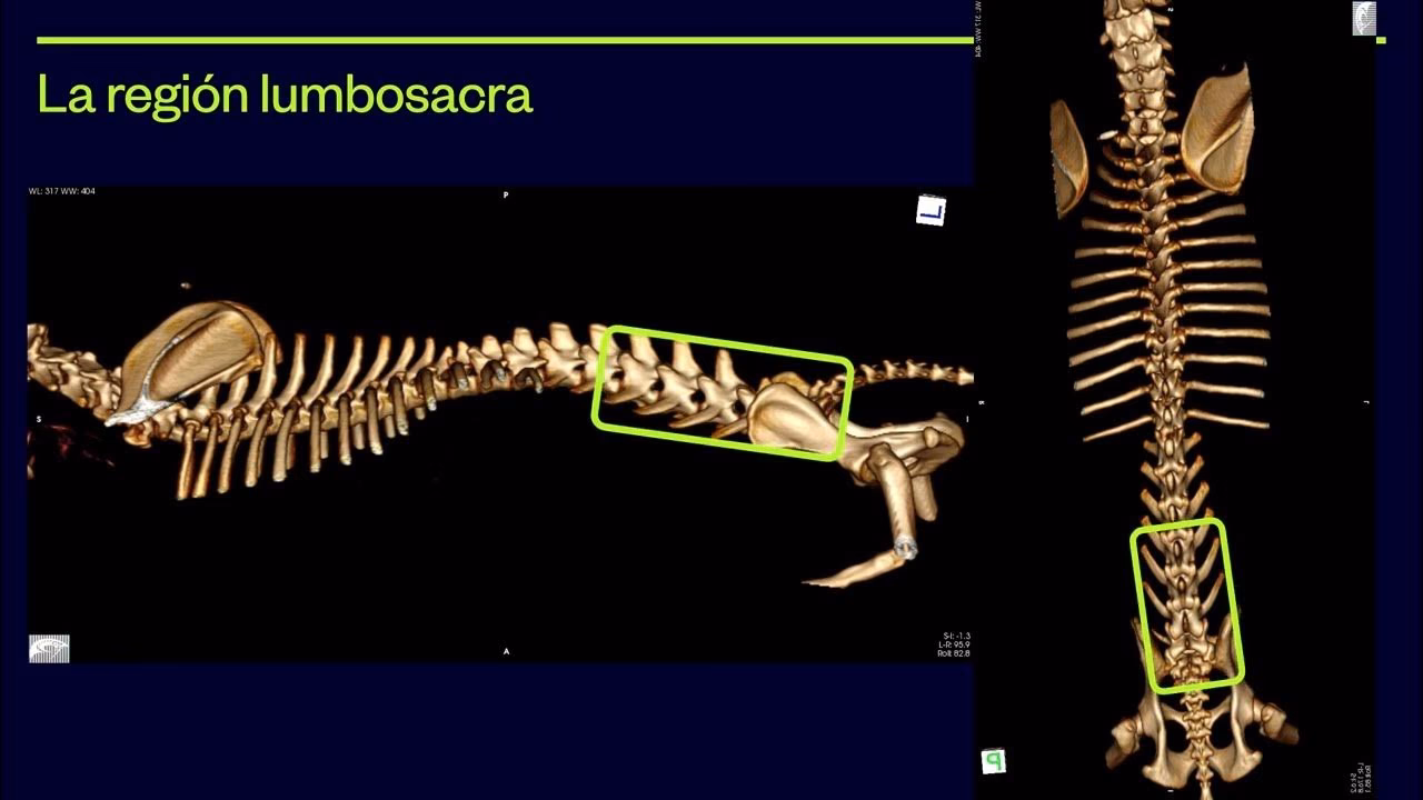 ¿Qué es la cauda equina?