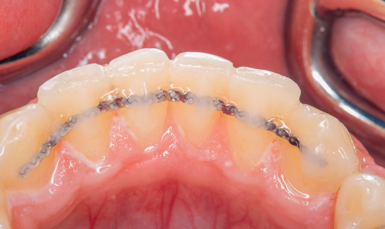 ¿Qué es la contención médica?