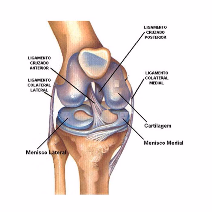 Quais são os diferentes tipos de cirurgias do joelho?
