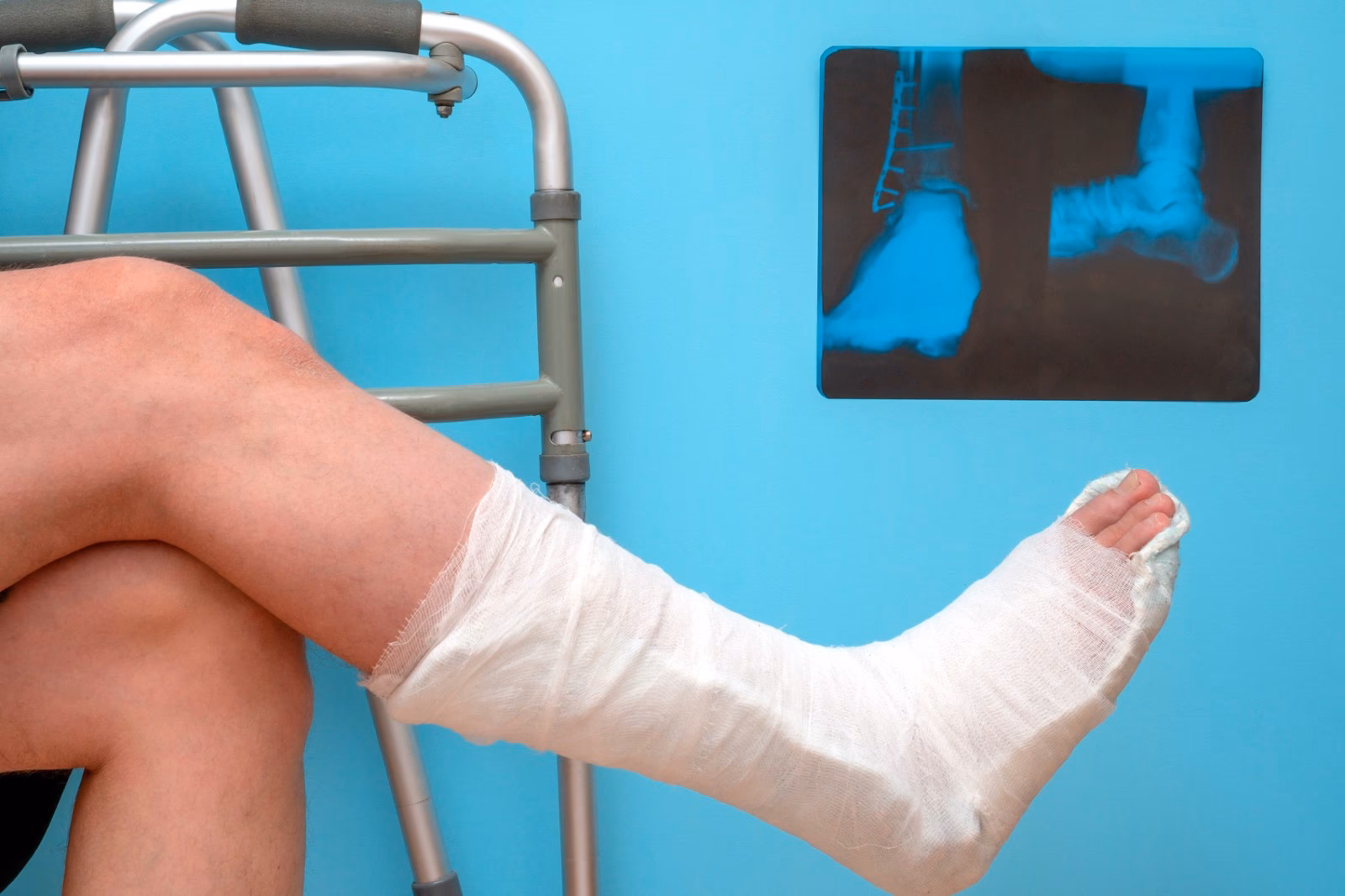 ¿Qué son los muelles para ortodoncia?