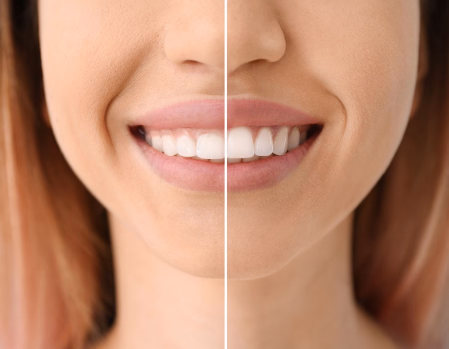 ¿Cuál es la función de las encías?