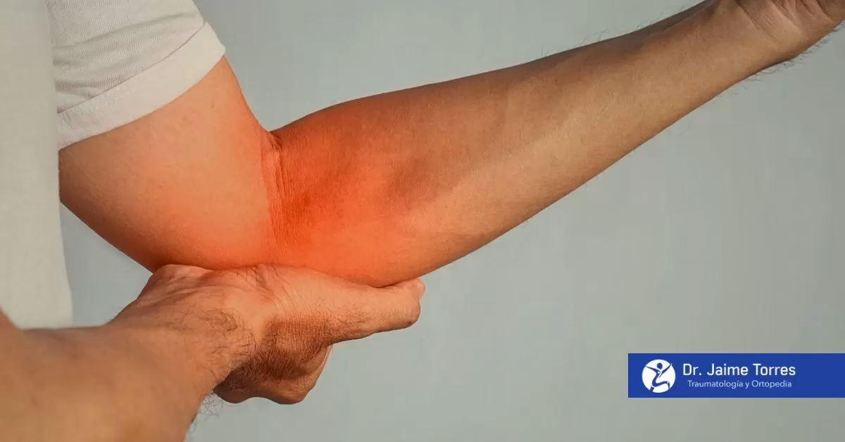 ¿Qué es la epitrocleitis o codo de golfista?