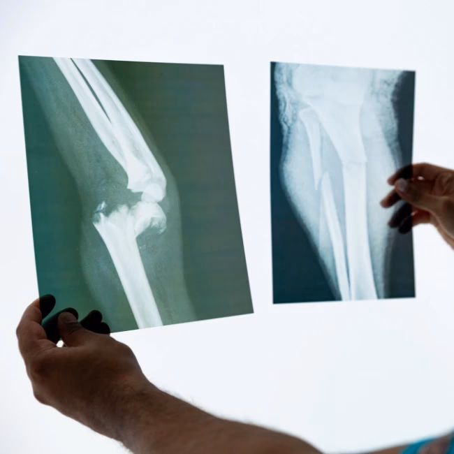 ¿Cómo se llama el genio de la ortopedia?