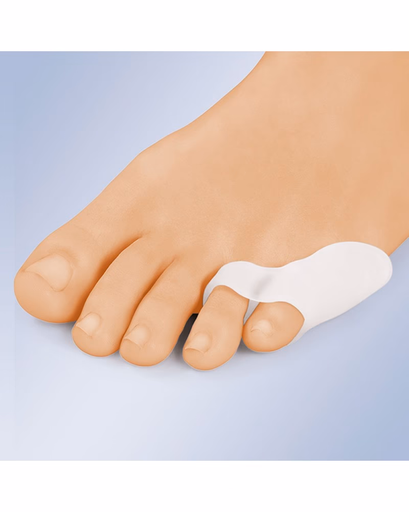 ¿Qué es la cirugía de juanetes?