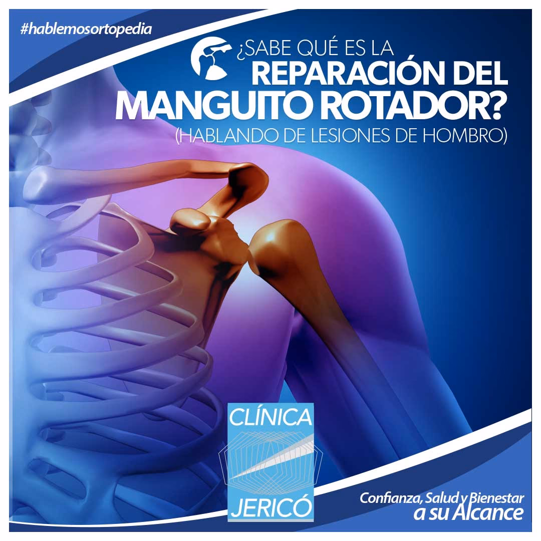 ¿Cuáles son las causas de la lesión del manguito rotador?