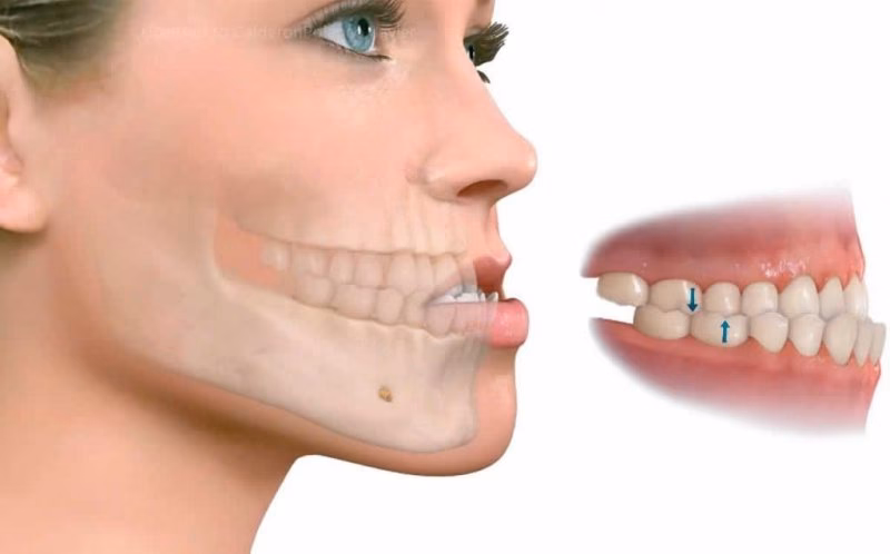 ¿Qué es la ortopedia maxilofacial?