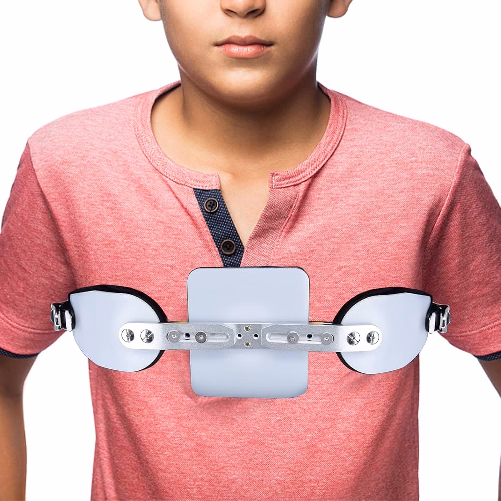 ¿Qué es el pectus carinatum?