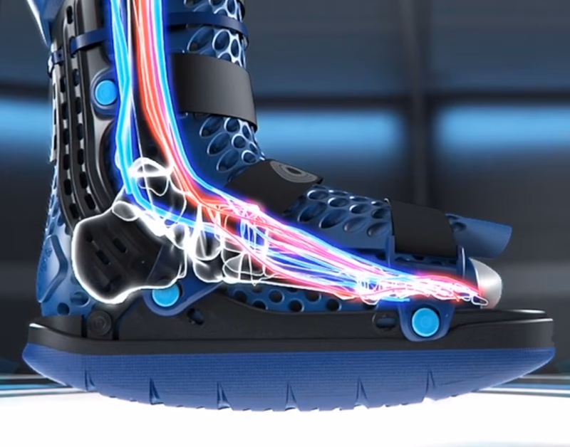 ¿Qué es Ortopedia Técnica Valdecilla?