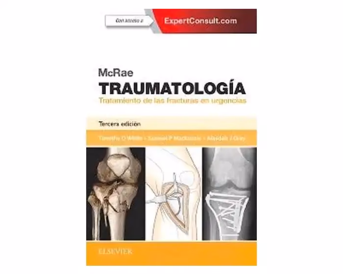 ¿Qué es la cirugía para las fracturas de olécranon?