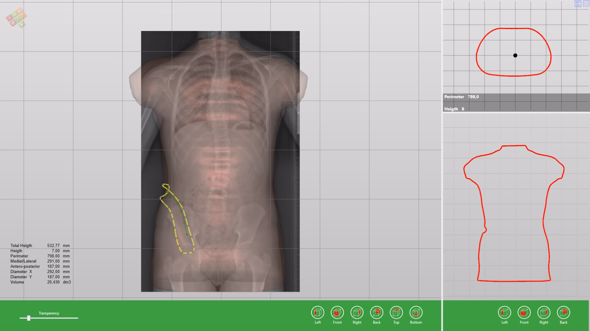 ¿Qué ofrece TraumaCad en el área de ortopedia?