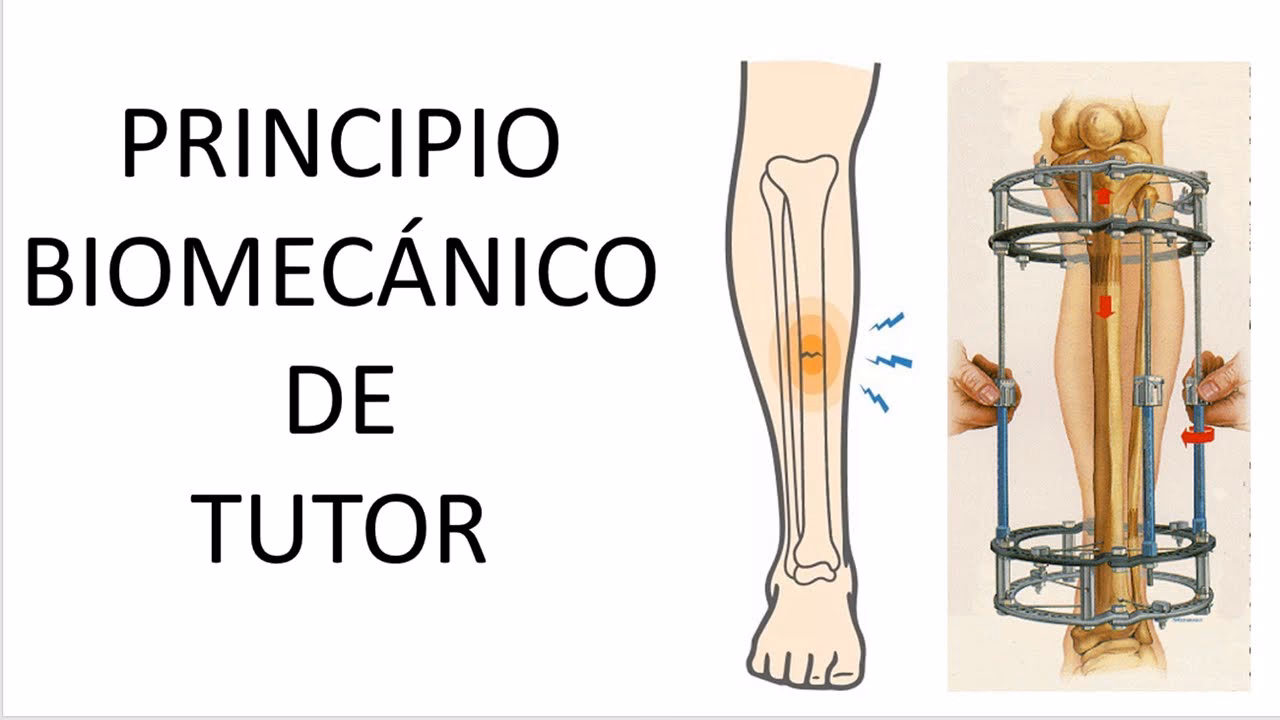 ¿Cómo recibir apoyo de un tutor especialista?